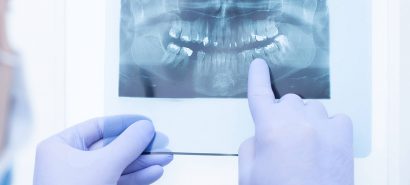 Automation of Dental Treatment Plan